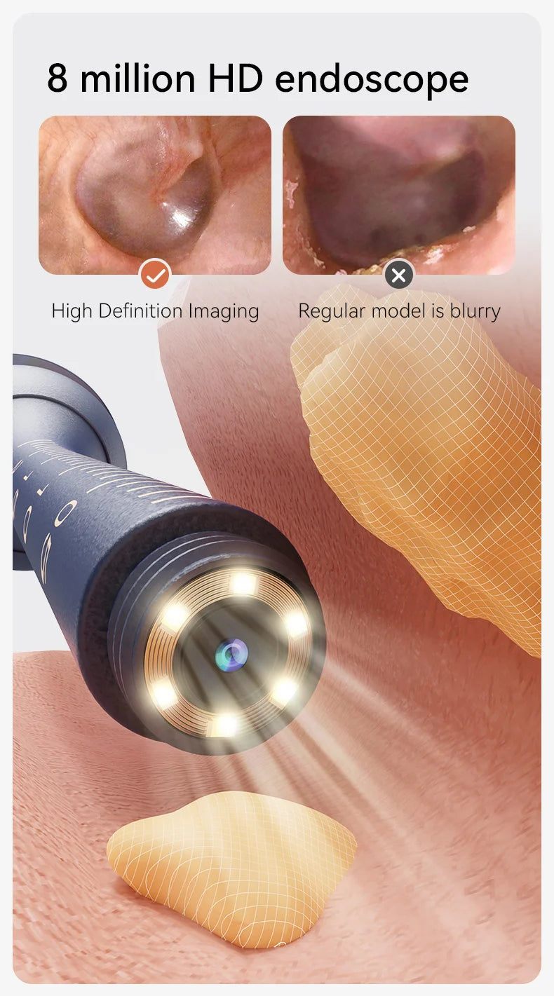 Nettoyeur de cire d'oreille visuel intelligent amélioré avec caméra