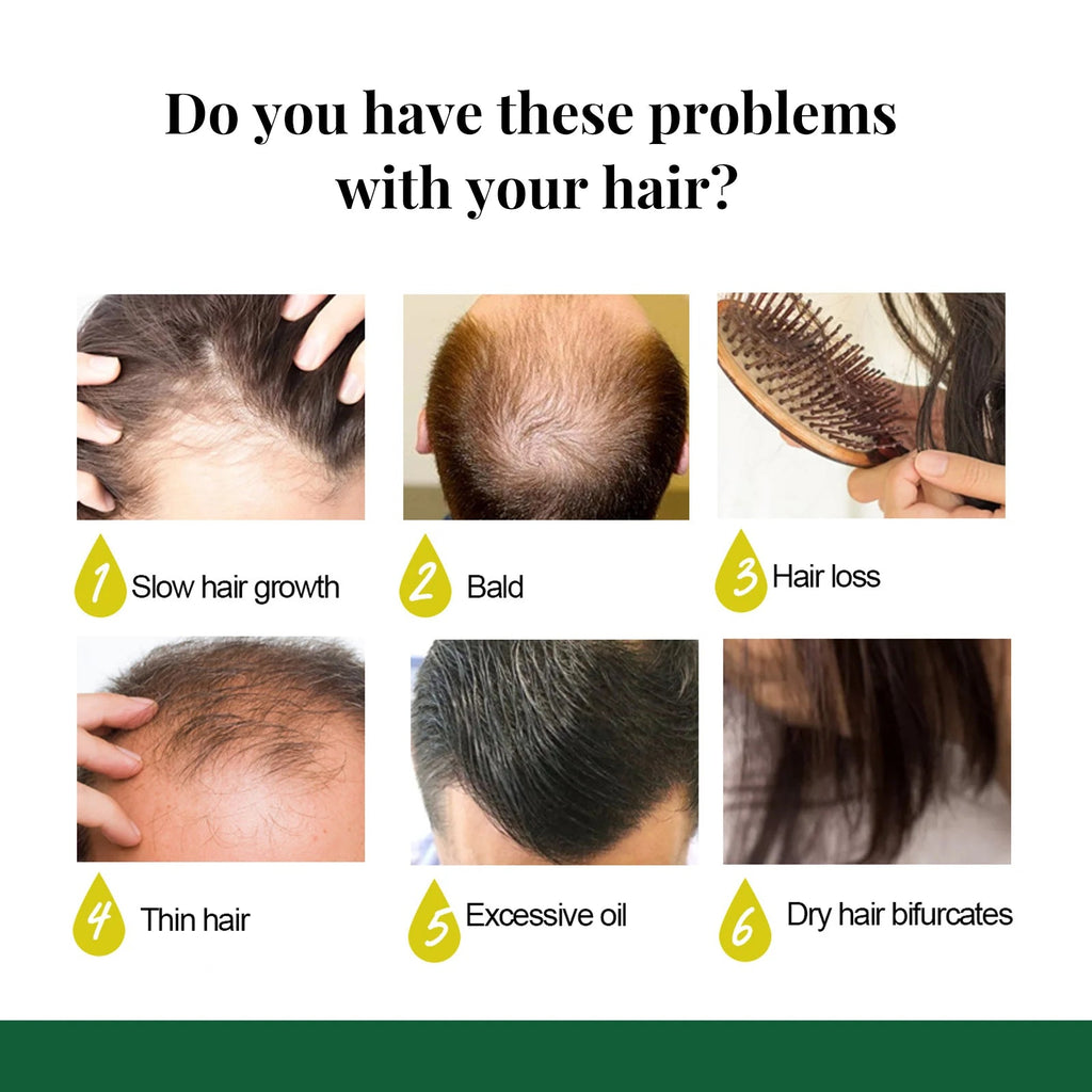 Spray Anti-Chute & Croissance Naturelle Belle Chevelure