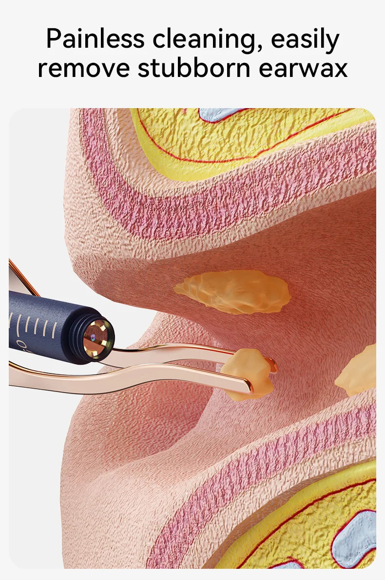 Nettoyeur de cire d'oreille visuel intelligent amélioré avec caméra